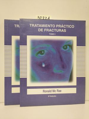TRATAMIENTO PRCTICO DE FRACTURAS